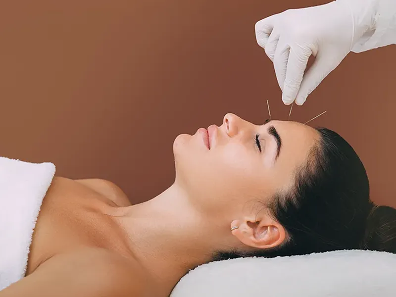 female acupuncturists
