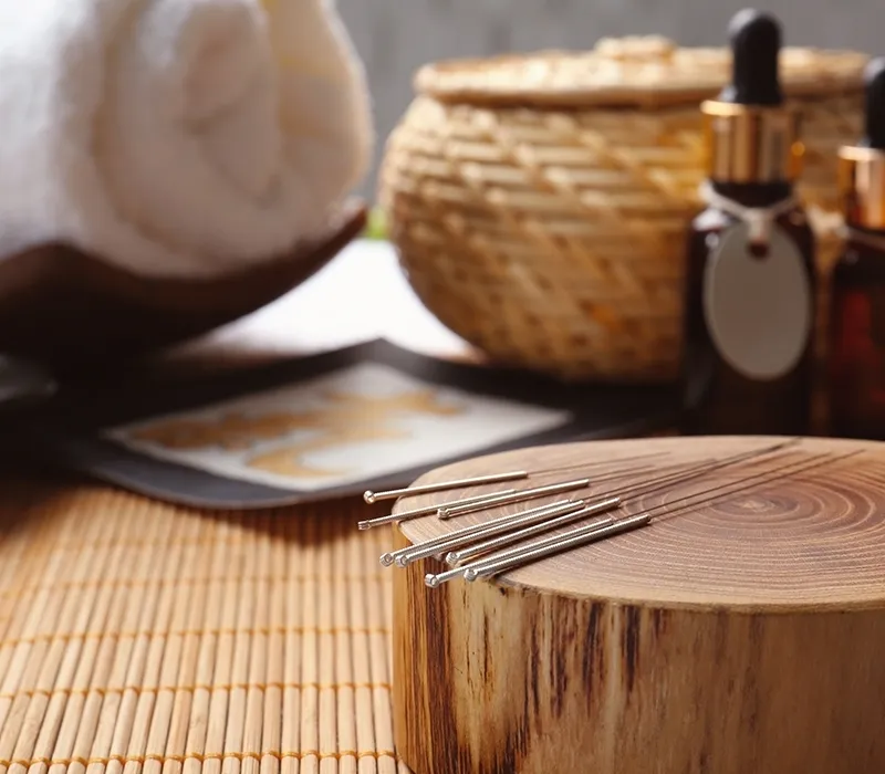 should acupuncture service