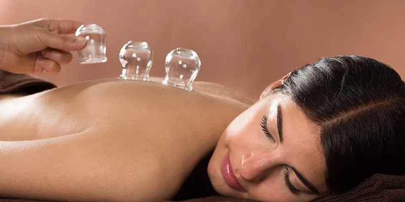 Fire Cupping