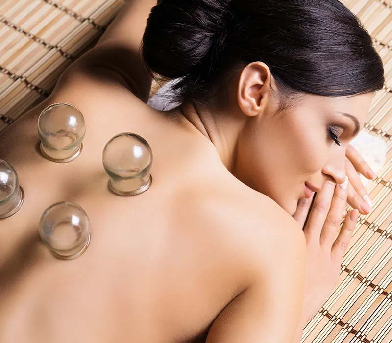 Fire Cupping