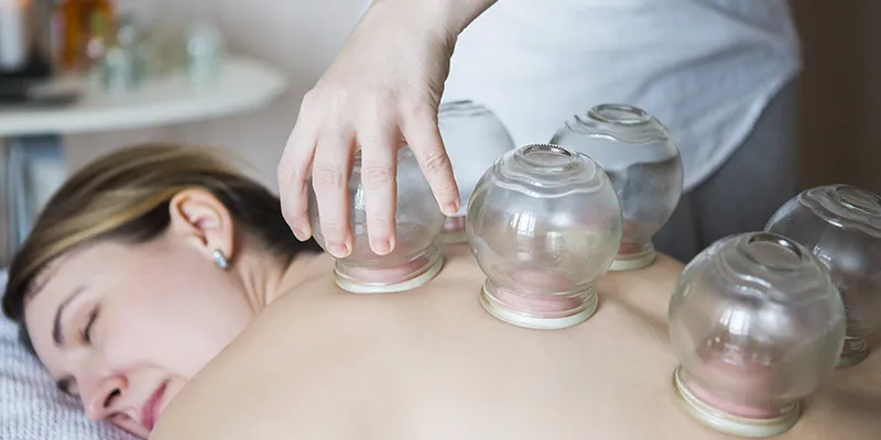 fire cupping