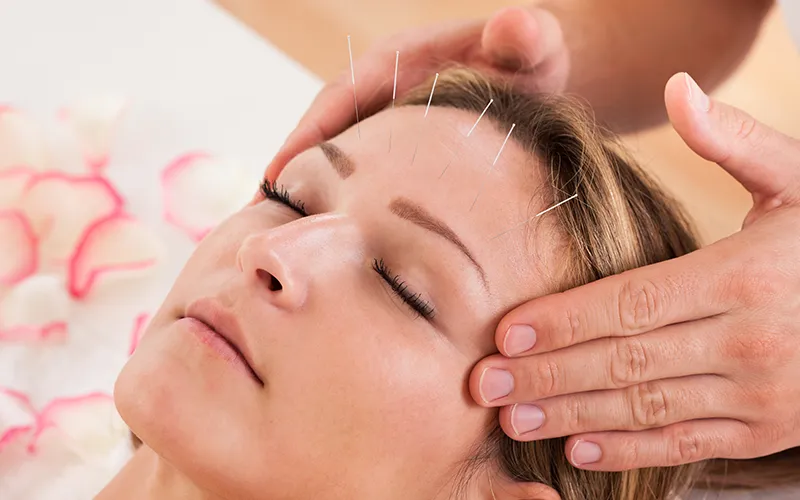 female head acupuncture