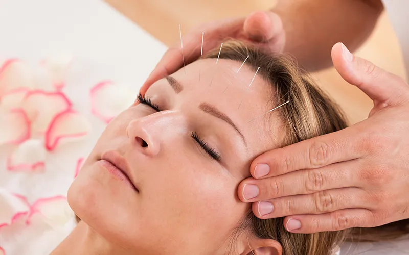 female head acupuncture