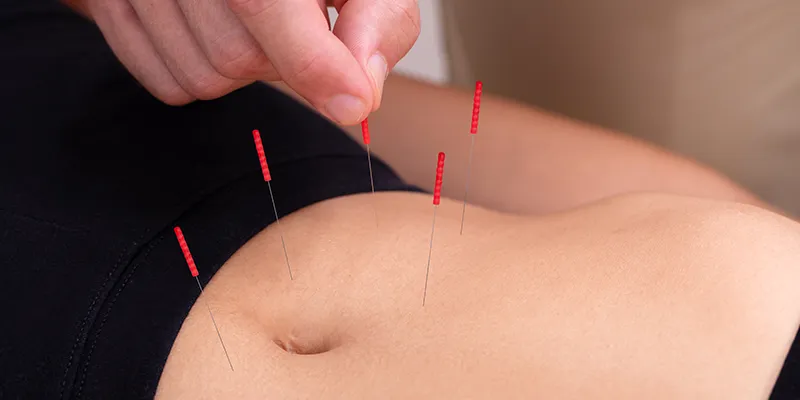 woman gut acupuncture